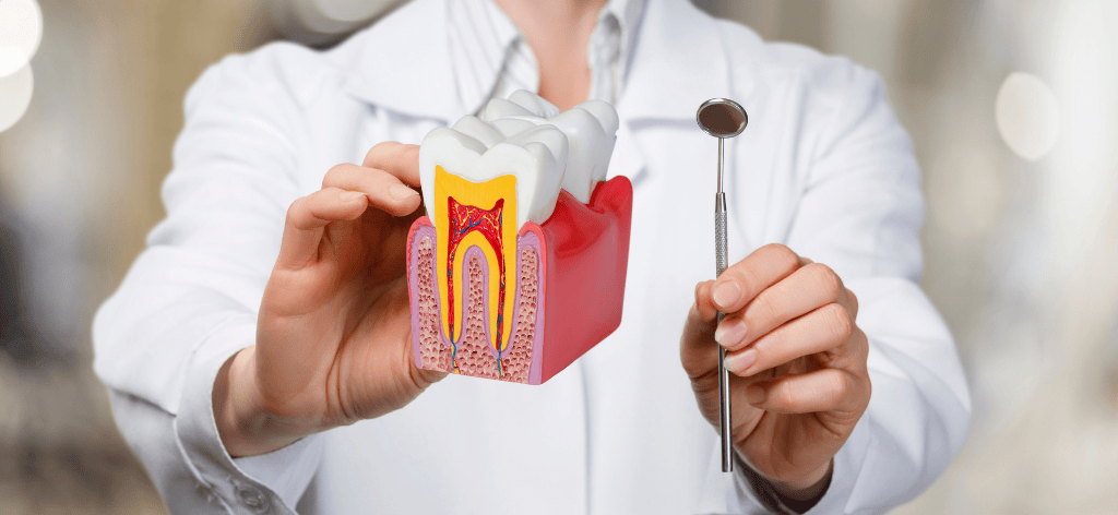 Dental Veneer in Chandigarh
